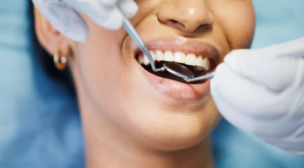 Best Emergency Wisdom Teeth Removal in Clarcona, FL